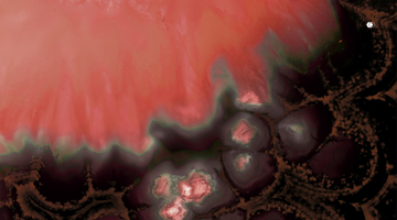 hidradenitis suppurativa lesion forming