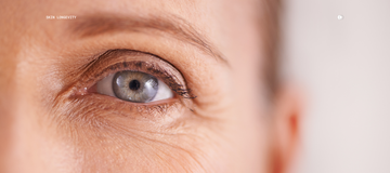 What Do Bacteria Have to Do With Crow's Feet? More Than You Think.