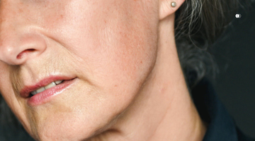 perimenopausal and menopausal skin