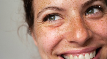Crow's feet are fine lines around the eyes