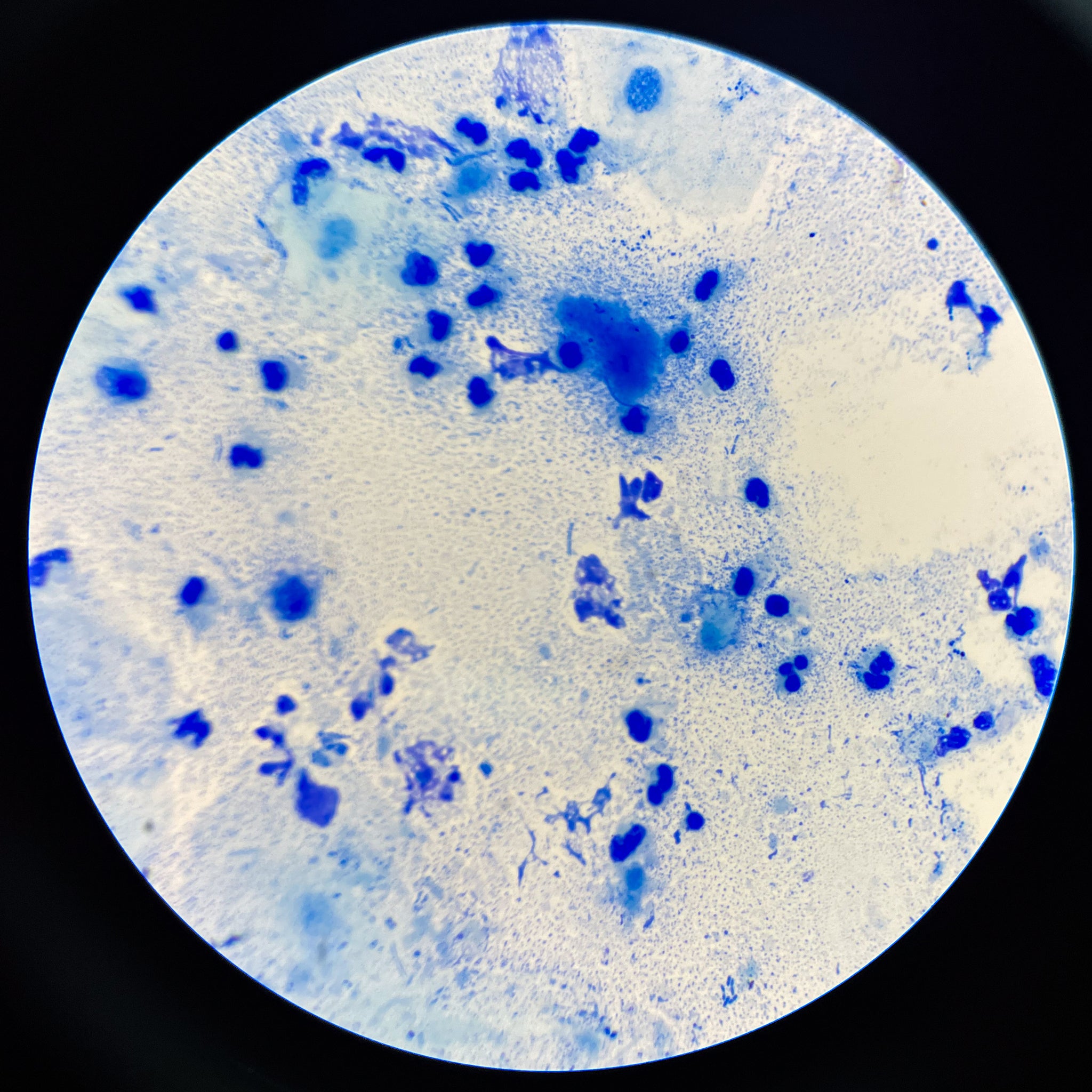When is it Time to Test Your Skin Microbiome? (Hint: it might be now!)